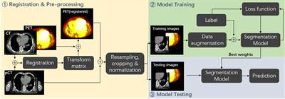 A deep learning approach for automatic tumor delineation in stereotactic radiotherapy for non-small cell lung cancer using diagnostic PET-CT and planning CT